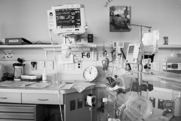 NICU Wires and Tubes